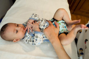 fisioterapia para bebes - tratamiento